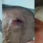 Árbitro é agredido por torcedores após jogo da Copa Interbairros em São Luís