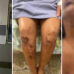 Mulher é brutalmente agredida em tentativa de abuso em Alto Alegre do Pindaré