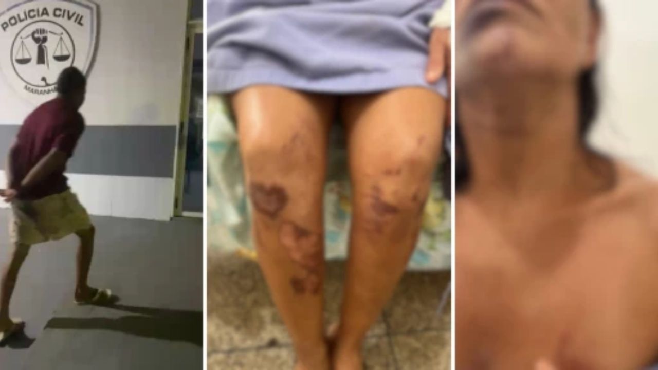 Mulher é brutalmente agredida em tentativa de abuso em Alto Alegre do Pindaré