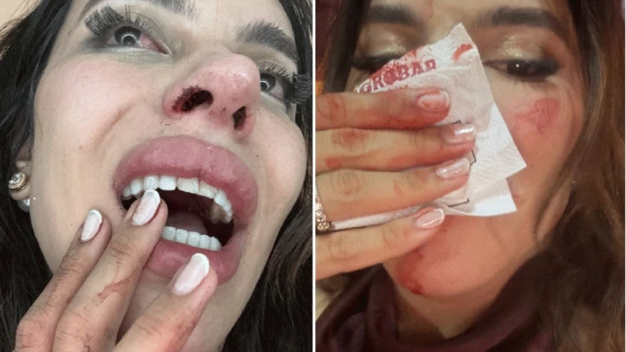 Influenciadora trans relata agressão em bar de Balsas; polícia apura possível transfobia