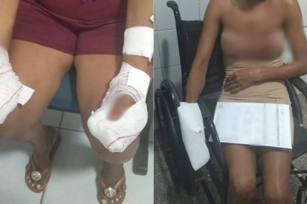 Homem é preso em flagrante suspeito de esfaquear a mãe e a namorada em Codó