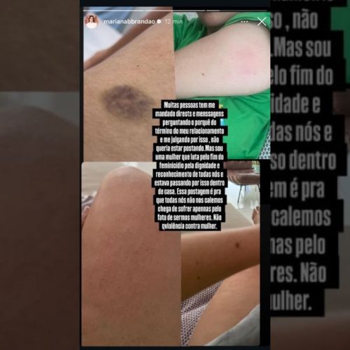 URGENTE — Paço do Lumiar: Vice-prefeita expõe agressões em post, repercute e apaga minutos depois