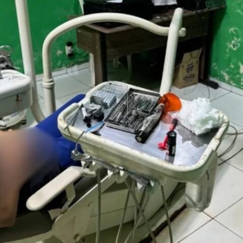 Técnico em prótese dentária é flagrado ao realizar atendimentos irregulares em em uma garagem em Itapecuru-Mirim